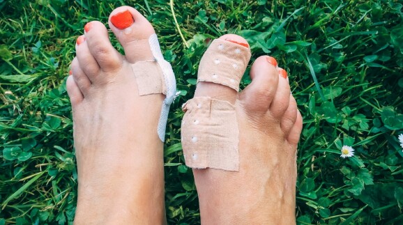 Zwei verletzte Füße mit Blasen und Pflastern auf grünem Rasen – symbolisches Bild für die Probezeit im Job: Ein Arbeitsplatz muss genauso gut passen wie Schuhe, sonst entstehen schmerzhafte Druckstellen.