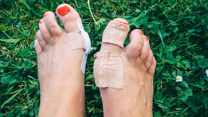 Zwei verletzte Füße mit Blasen und Pflastern auf grünem Rasen – symbolisches Bild für die Probezeit im Job: Ein Arbeitsplatz muss genauso gut passen wie Schuhe, sonst entstehen schmerzhafte Druckstellen.